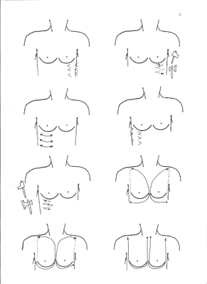 brest-massage2.gif