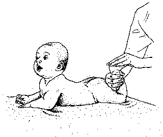 Эффективное применение массажа при косолапости у детей
